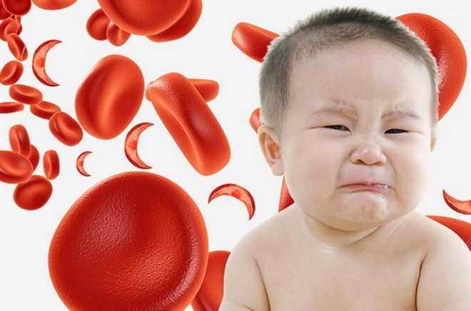 Bệnh Celiac có thể dẫn đến thiếu máu ở trẻ