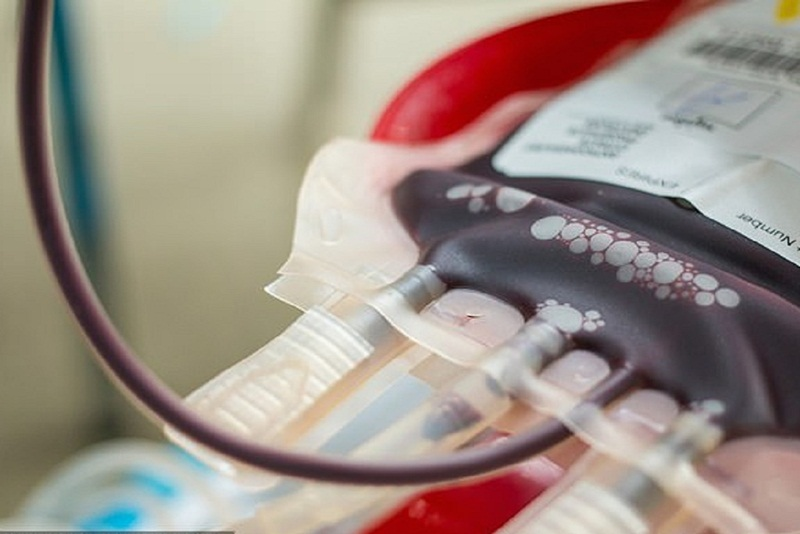 Truyền máu là một trong những cách bổ sung sắt cho trẻ